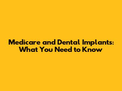 Medicare and Dental Implants: What You Need to Know